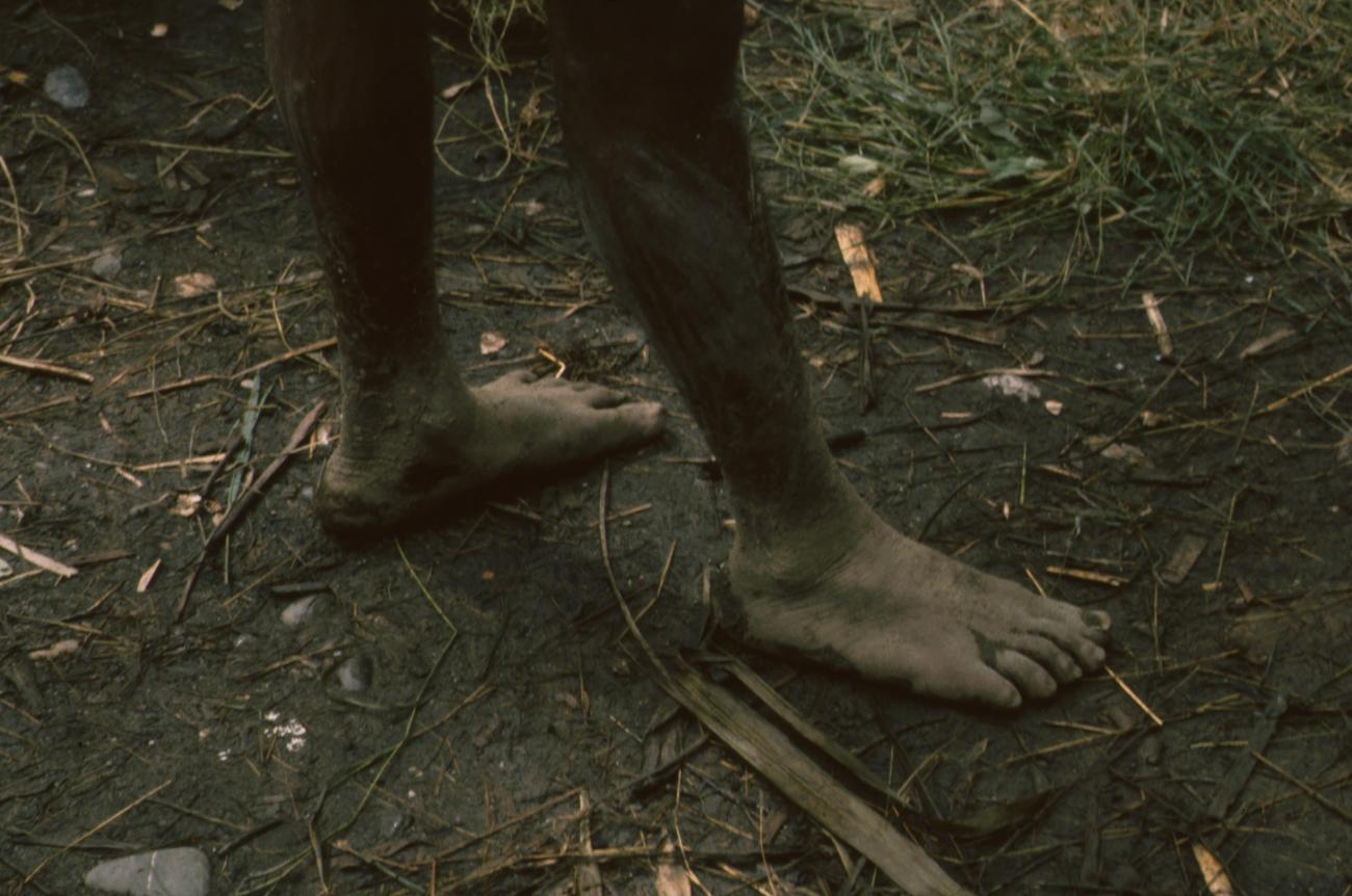 BD/166/383 - 
A Papua man&#039;s feet
