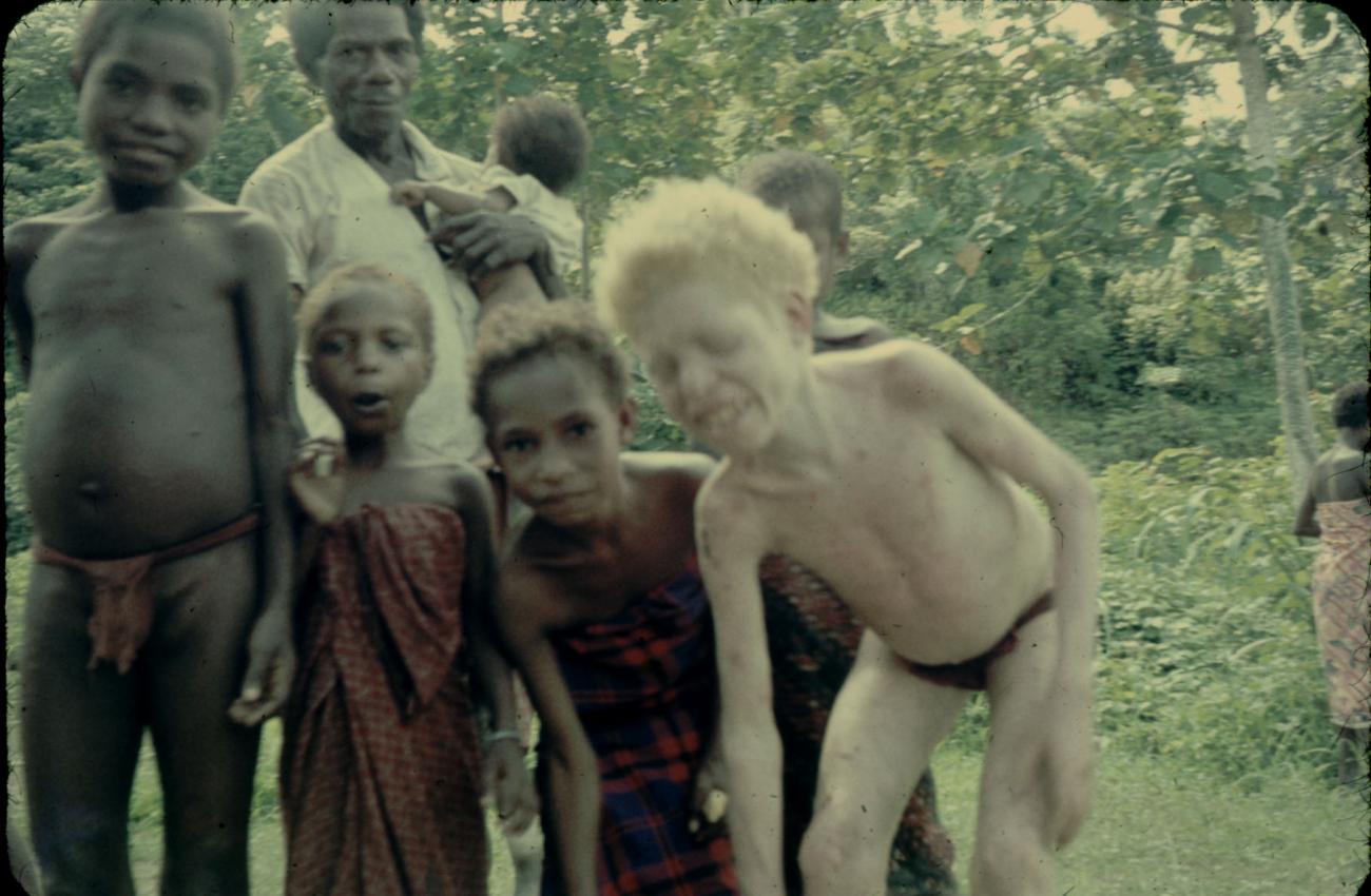 BD/144/269 - 
Groepsfoto papoea-kinderen met o.m. albino
