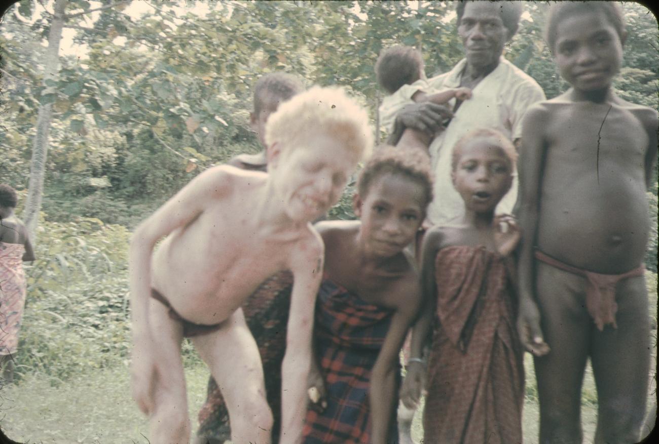 BD/144/67 - 
Groepsfoto, onder meer albino-kind 
