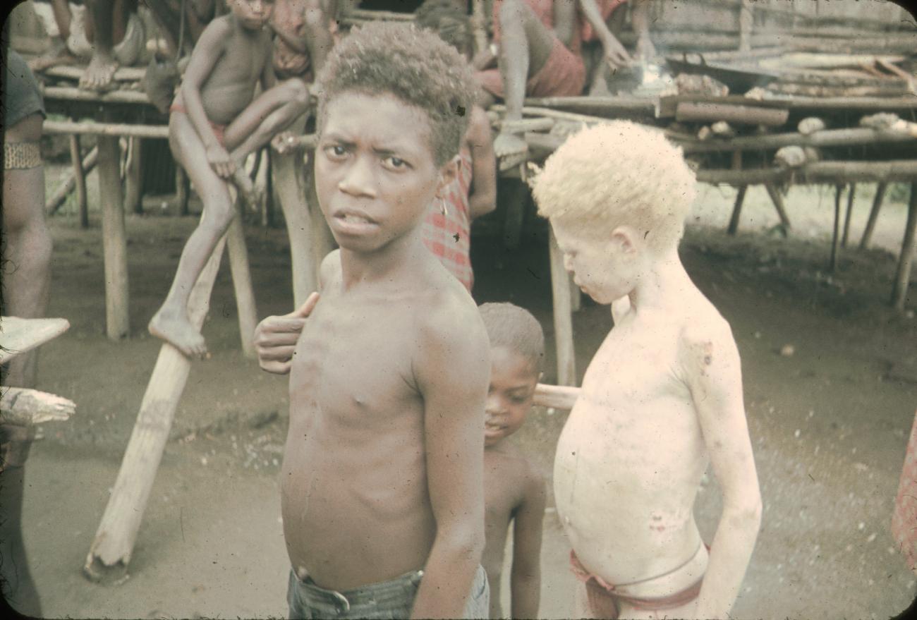 BD/144/73 - 
Groepsfoto kinderen zwerfstam, o.m. albino-kind
