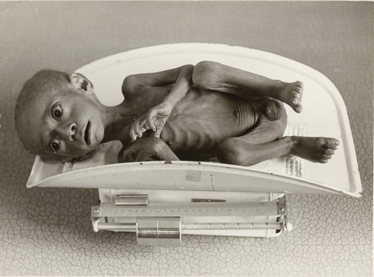 BD/326/4 - 
Ondervoed kind op de weegschaal in het ziekenhuis van Enarotali
