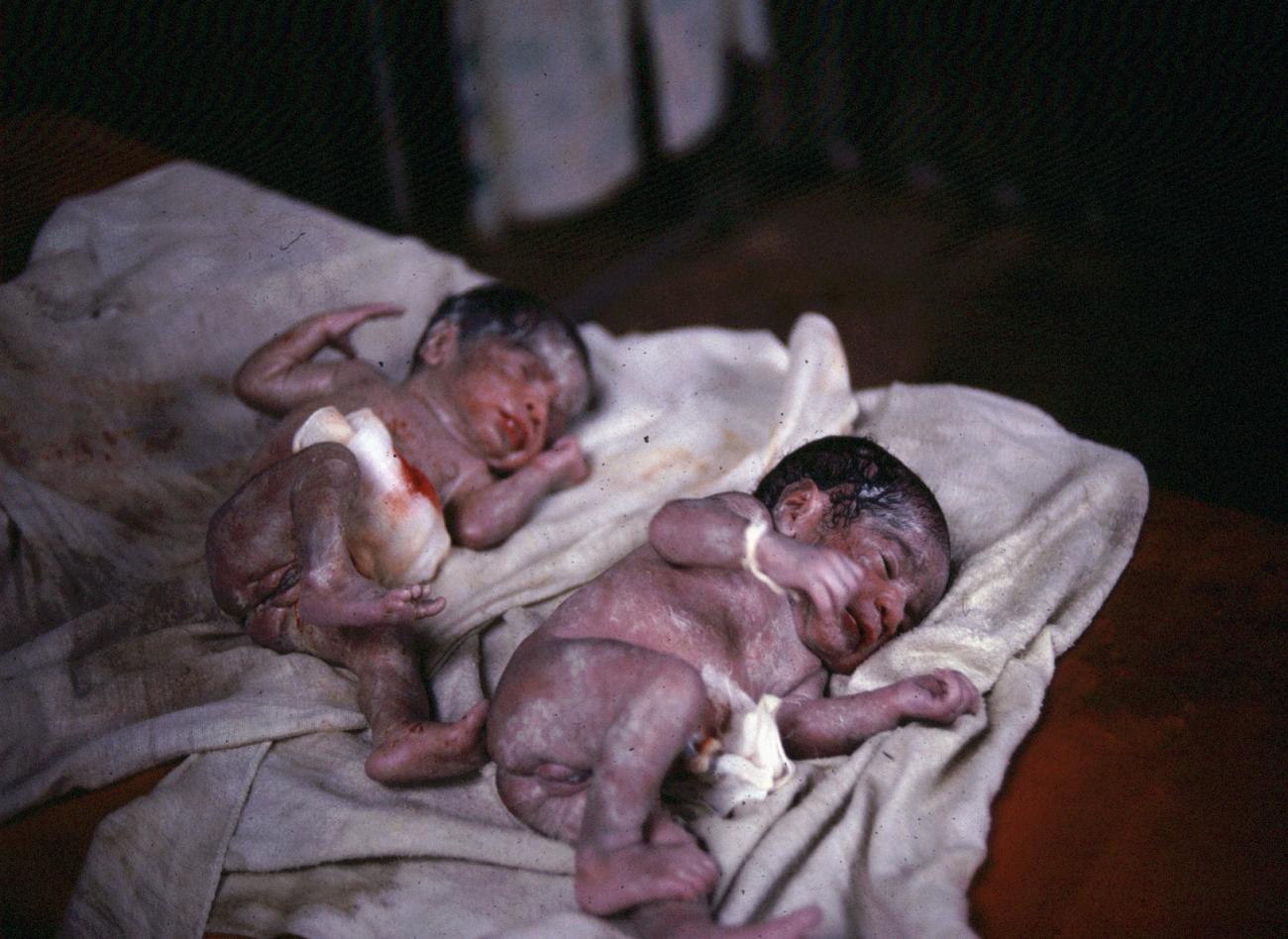 BD/289/120 - 
Verpleegkundige met zojuist geboren tweeling
