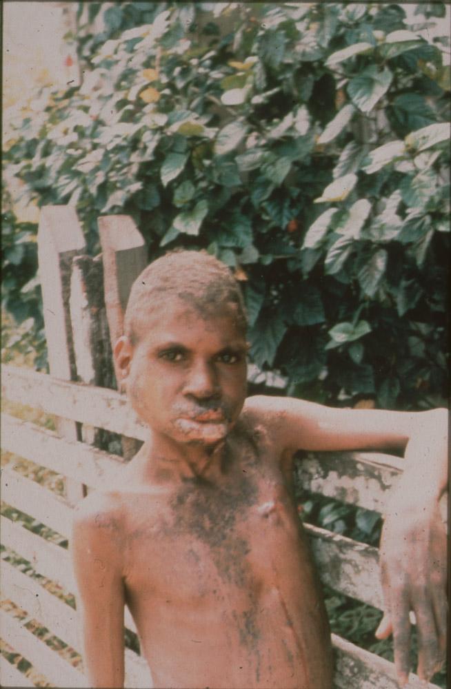 BD/30/92 - 
Asmat boy leaning on a fence
